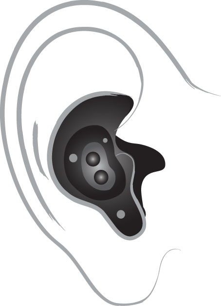 In the ear hearing aid diagram